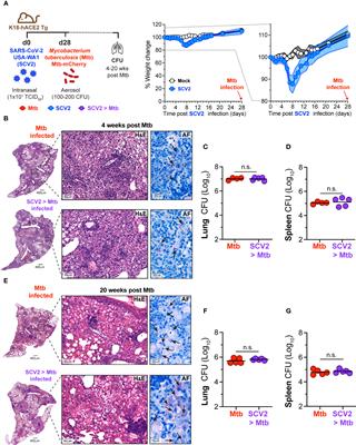 Co-infection of mice with SARS-CoV-2 and Mycobacterium tuberculosis limits early viral replication but does not affect mycobacterial loads